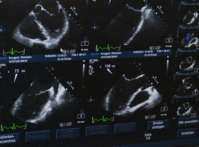 Ultrazvukové snímky
